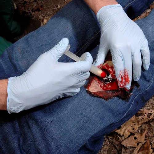 Аппликатор гемостатический с гранулами Rhino Rescue в Коломне хитозановый